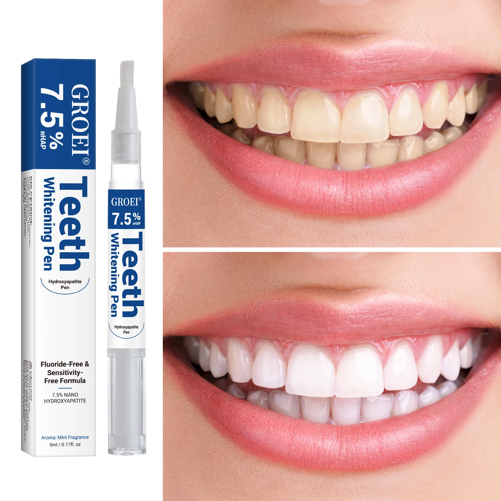 Pluma blanqueadora de dientes  - Teeth Whitening Diy reseña y precio