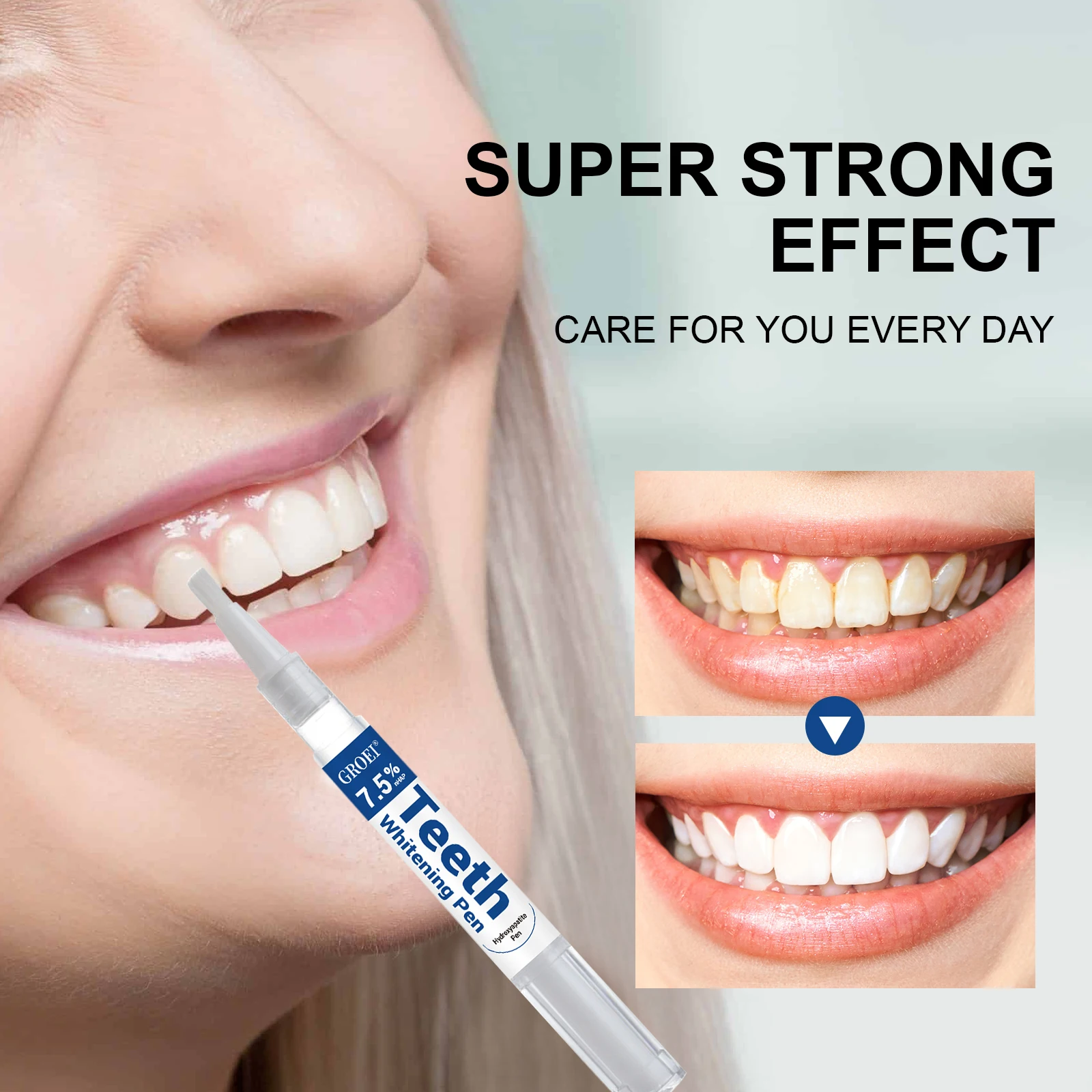 Pluma blanqueadora de dientes  - Teeth Whitening Diy reseña y precio
