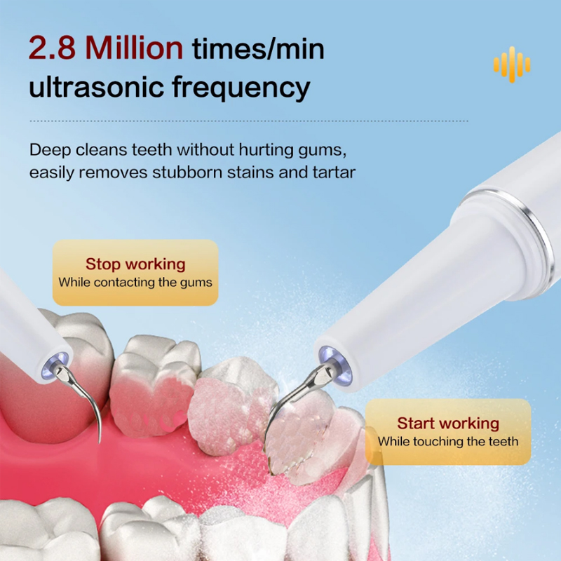 KLXKLX YOUPIN Limpiador Dental - Water Flosser Cordless reseña y precio