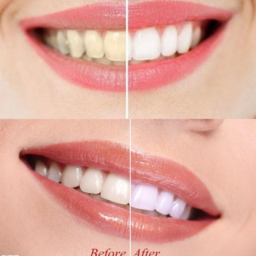 Dientes de carbón de bambú par - Teeth Paint Whitening reseña y precio