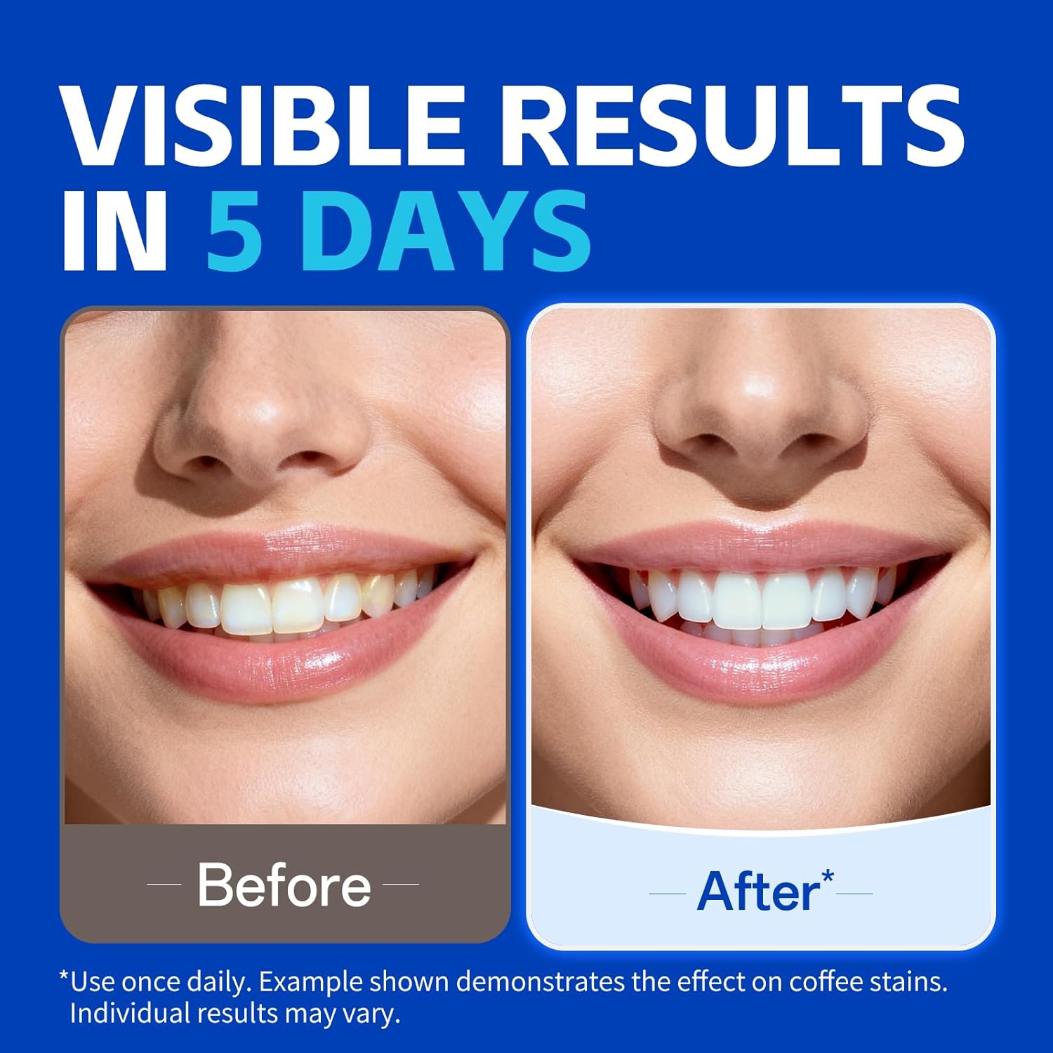 7 pares de tiras blanqueadoras - Teeth Whitening Strips Permanent reseña y precio