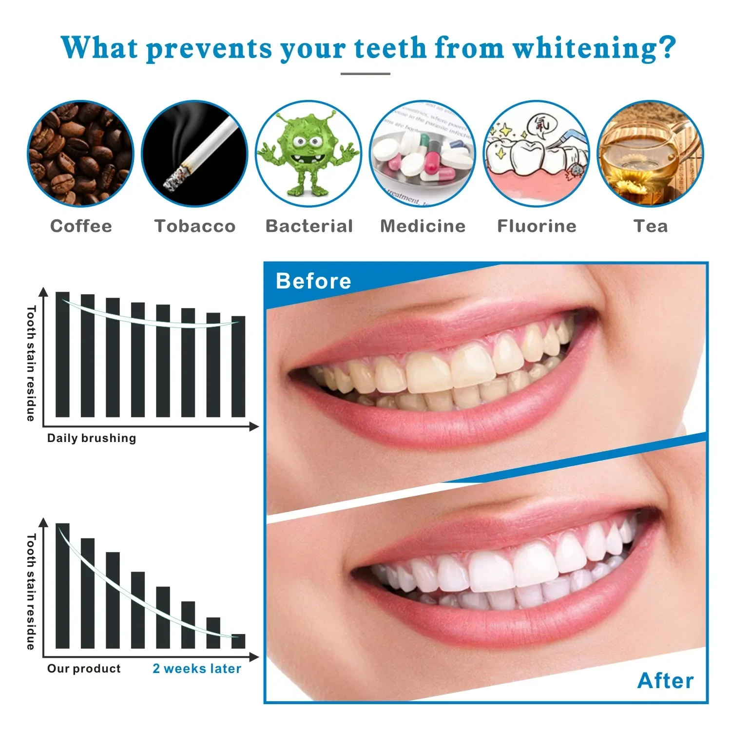 14/28 Uds. Tiras blanqueadoras - Whitening Strip 3D reseña y precio