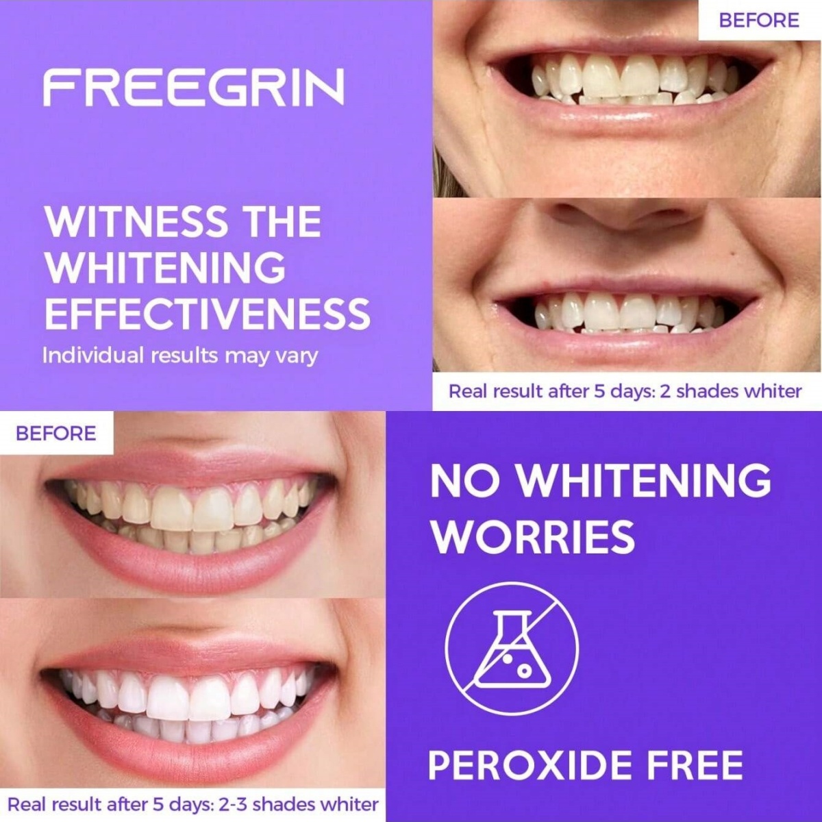 Pegatinas blanqueadoras de die - Teeth Whitening Gel Peroxide reseña y precio